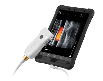 Ултразвукова медицинска сканиране USB, издут линия на ултразвукова сонда, интелигентен Ч/Б цветна доплеровский преносим ултразвук POC въз основа на заявление