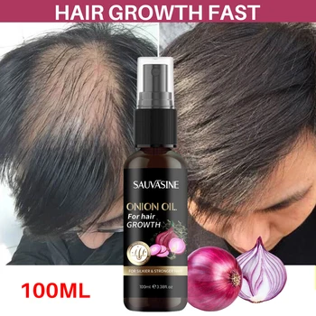 Лук олио за коса за бърз растеж на косата Етерично масло против косопад, Масло за грижа за кожата на главата за мъже и жени средство за растеж на косата